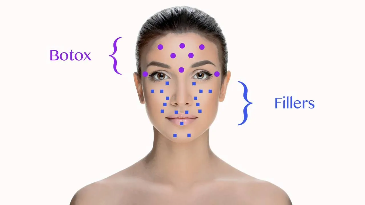 4 Differences Between Botox and Fillers