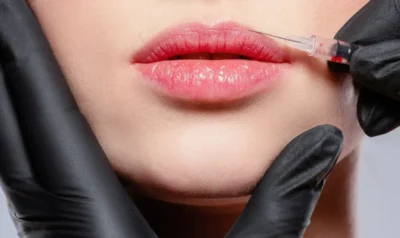 Lip Botox