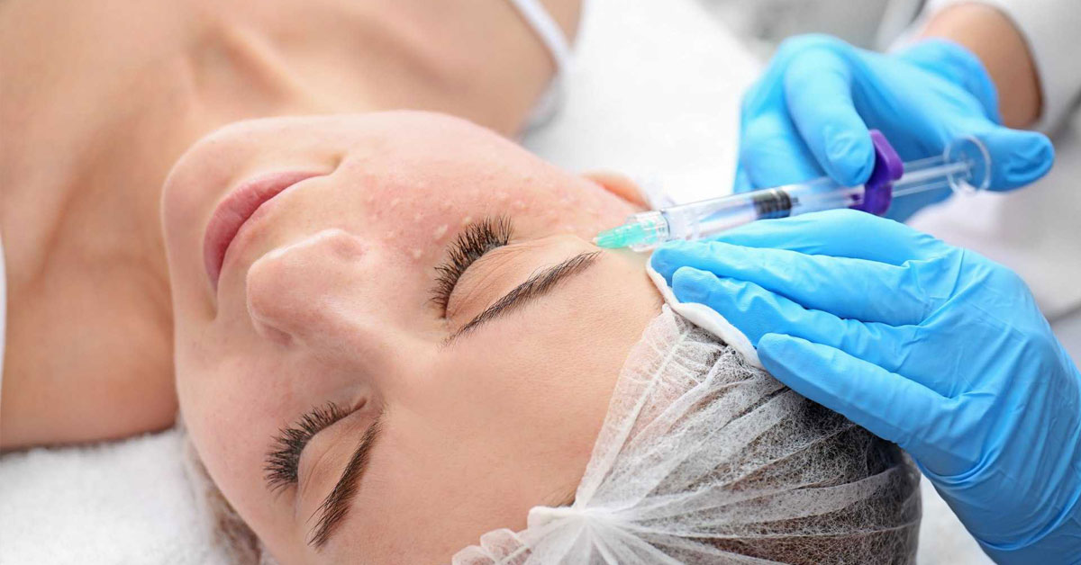 Facial Mesotherapy